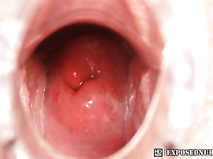 Teen nurse Gabina opens her pussy with speculum to show her pussy cervix